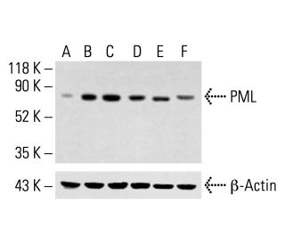PML Antibody (5G191) - Western Blotting - Image 413312 