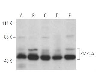 PMPCA Antibody (B-8) - Western Blotting - Image 394974 