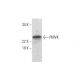 PMVK Antibody (H-9) - Western Blotting - Image 290888 