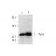 PMVK Antibody (H-9) - Western Blotting - Image 294399 