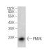 PMVK Antibody (H-9) - Western Blotting - Image 373422