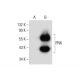 PNK Antibody (A-4) - Western Blotting - Image 134066 