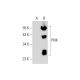 PNK Antibody (E-9) - Western Blotting - Image 130357