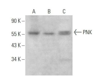 PNK Antibody (E-9) - Western Blotting - Image 359140 