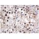 PNK Antibody (F-3) - Immunohistochemistry - Image 160234 