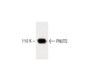 PNUTS Antibody (47) - Western Blotting - Image 60419 
