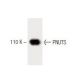 PNUTS Antibody (47) - Western Blotting - Image 60419 
