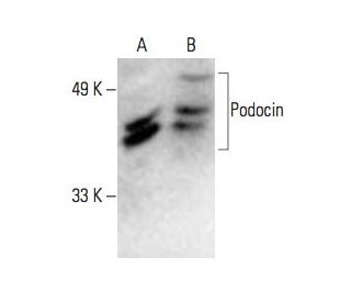 Podocin Antibody (G-5) - Western Blotting - Image 394299