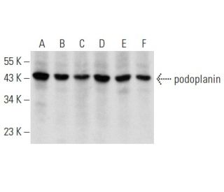 podoplanin Antibody (F-3) - Western Blotting - Image 354335 