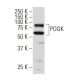 POGK Antibody (5Q13) - Western Blotting - Image 34017