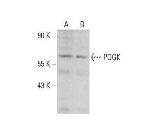 POGK Antibody (5Q13) - Western Blotting - Image 308552 