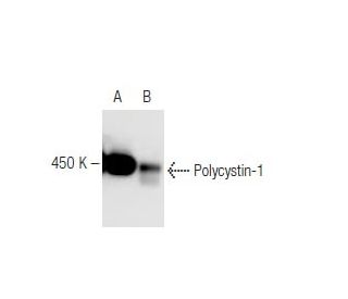 Polycystin-1 Antibody (7E12) - Western Blotting - Image 67392SAM Transcription Activation: SAM system utilizing dCas9-VP64, MS2-P65-HSF1, and sgRNA for precise gene transcription activation.