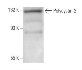 Polycystin-2 Antibody (YCE2) - Western Blotting - Image 11975 