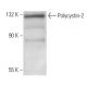 Polycystin-2 Antibody (YCE2) - Western Blotting - Image 11975 
