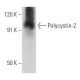 Polycystin-2 Antibody (YCE2) - Western Blotting - Image 354301