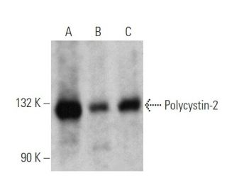 Polycystin-2 Antibody (D-3) - Western Blotting - Image 360587