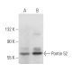 Pontin 52 Antibody (H-4) - Western Blotting - Image 356947 