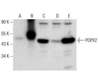 POPX2 Antibody (B-11) - Western Blotting - Image 297969 