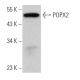 POPX2 Antibody (B-11) - Western Blotting - Image 367720