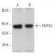 POPX2 Antibody (B-11) - Western Blotting - Image 367723 
