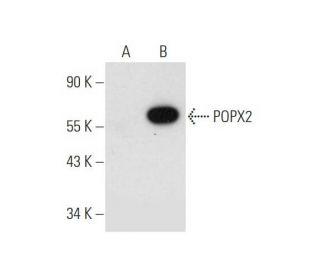 POPX2 Antibody (B-7) - Western Blotting - Image 332790 