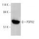 POPX2 Antibody (B-7) - Western Blotting - Image 364928