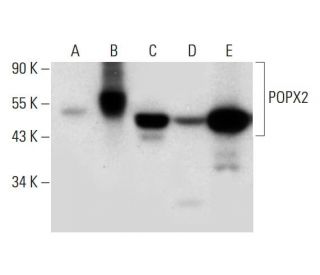 POPX2 Antibody (G-10) - Western Blotting - Image 297968 