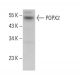POPX2 Antibody (G-11) - Western Blotting - Image 378124