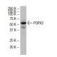 POPX2 Antibody (SJ-6) - Western Blotting - Image 33789