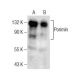 Porimin Antibody (D-9) - Western Blotting - Image 281888