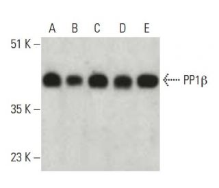 PP1&beta; Antibody (A-6) - Western Blotting - Image 396491 