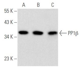 PP1&beta; Antibody (D-11) - Western Blotting - Image 355790 
