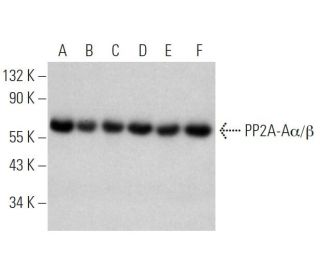 PP2A-A&alpha;/&beta; Antibody (H-11) - Western Blotting - Image 370483 