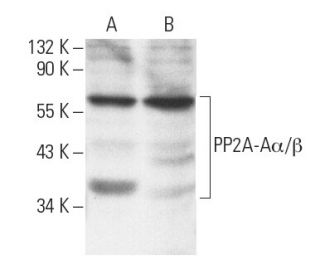 PP2A-A&alpha;/&beta; Antibody (4G7) - Western Blotting - Image 2306 