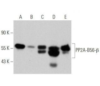 PP2A-B56-&beta; Antibody (E-6) - Western Blotting - Image 356258 