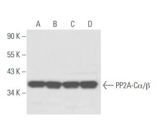 PP2A-C&alpha;/&beta; Antibody (7A6) - Western Blotting - Image 57845 