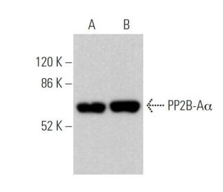 PP2B-Aα Antibody (D-9) - Western Blotting - Image 360194