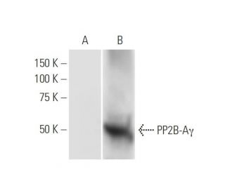 PP2B-A&gamma; Antibody (4D1) - Western Blotting - Image 347568 