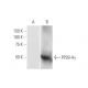 PP2B-Aγ Antibody (4D1) - Western Blotting - Image 347568 
