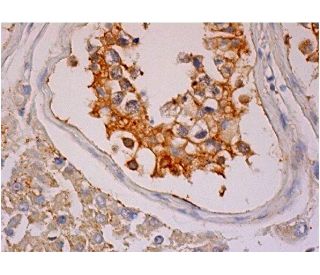PP2B-B1/2 Antibody (D-1) - Immunohistochemistry - Image 286412 
