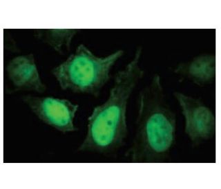 PP2B-B1 Antibody (70-A) - Immunofluorescence - Image 53886 
