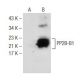 PP2B-B1 Antibody (70-A) - Western Blotting - Image 148844