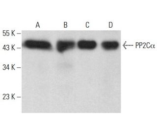 PP2C&alpha; Antibody (7F12) - Western Blotting - Image 376497 