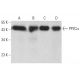 PP2Cα Antibody (7F12) - Western Blotting - Image 376497 