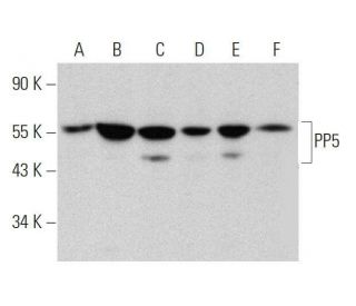 PP5 Antibody (F-8) - Western Blotting - Image 359390 