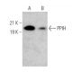 PPIH Antibody (G-6) - Western Blotting - Image 374878 