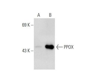 PPOX Antibody (42J-6) - Western Blotting - Image 127821
