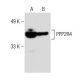 PPP2R4 Antibody (5G3) - Western Blotting - Image 150907