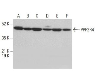 PPP2R4 Antibody (5G3) - Western Blotting - Image 377990 