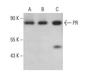 Progesterone Receptor Antibody (A-2) - Western Blotting - Image 376219 